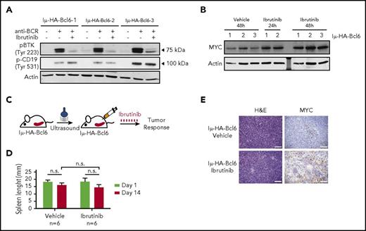 Figure 3. MYC is upregulated in IμHABCL6 animals harboring ibrutinib-resistant DLBCL. (A) Western blot analysis of pBTK (Tyr223) and pCD19 (Tyr531) in purified murine B-cells pretreated with DMSO or ibrutinib (0.5 μM) for 6 hours and stimulated with H2O2 for 3 minutes. (B) Western blot analysis of MYC levels in purified tumor B cells from 18- to 20-month-old IμHABCL6 mice. Cells isolated from each animal were divided in 3 aliquots and kept in culture in the presence of DMSO or ibrutinib (0.5 μM) for 24 or 48 hours. (C) Pipeline for ibrutinib treatment in IμHABCL6 mice. Spleen size was assessed by ultrasound in 13- to 21-month-old mice. Mice enrolled in the study were treated with ibrutinib (12 mg/kg per day IP) for 14 days. (D) Spleen length in IμHABCL6 mice measured by ultrasound at day 1 and 14 in animals treated with ibrutinib or vehicle. Data are shown as a bar graph corresponding to the mean of 6 mice ± SD. P values were calculated using 2-tailed Student t test. (E) Representative images of immunohistochemistry analyses of IμHABCL6 mice spleen tissues. Scale bars, 100 μm. H&E, hematoxylin and eosin; n.s., not statistically significant.
