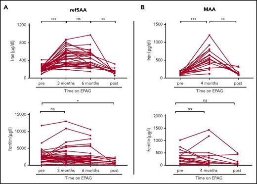 Figure 1. Iron and ferritin concentrations in patients with aplastic anemia in relation to EPAG treatment. Longitudinal values of plasma iron (measured by colorimetric assay; reference range, 37-145 µg/dL in females and 59-158 µg/dL in males) and ferritin (measured by immunoassay; reference range, 13-150 µg/L in females and 30-400 µg/L in males) in (A) refSAA patients and (B) MAA patients before, during, and after EPAG treatment. RefSAA patients with iron studies available from baseline and at least one follow-up time point at 3 or 6 months of EPAG treatment were included in the analysis (38 of 40 enrolled patients). Selected MAA patients shown in panel B (n = 19) received no red blood cell transfusions on study (see supplemental Figure 1 for iron studies for the entire MAA study cohort). Posttreatment iron studies were performed at a median 12 months (range, 0.7-25.2 months) after EPAG was discontinued in refSAA patients and 2 months in MAA patients (range, 1.0-7.3 months). P values were calculated on the basis of paired Student t tests. ***P < .001; **P < .01; *P < .05. ns, not significant.