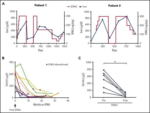 Figure 2. Plasma iron and ferritin concentrations in aplastic anemia patients treated long term with EPAG. (A) Dose of EPAG administered and iron concentrations in 2 MAA patients from protocol initiation through current follow-up. EPAG was discontinued per protocol criteria for robust hematologic response on day 299 in patient 1 and on day 371 in patient 2. Subsequently, both patients experienced declining blood cell counts, and EPAG was re-initiated at the last effective dose per protocol. After achieving a second robust response, the EPAG dose was slowly tapered in both patients. Neither patient received concomitant iron chelators or red blood cell transfusions. (B) Ferritin levels in MAA patients with an EPAG treatment duration of at least 4 months. No patient received red blood cell transfusions, therapeutic phlebotomy, or pharmacological chelation during the time intervals graphed. The black circles indicate the time point of EPAG discontinuation. (C) Comparison of ferritin levels pretreatment and after EPAG discontinuation (first measurement after EPAG discontinuation corresponds to black circles in panel B) in 6 MAA patients with prolonged EPAG treatment and ferritin measurements available at follow-up. P value was calculated on the basis of paired Student t tests. **P = .005.