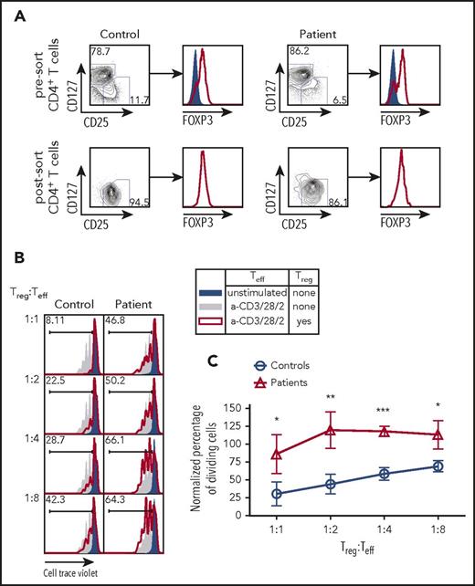 Figure 4. Treg suppression assay from fluorescent activated cell sorting purified Treg cells in CD3G-mutated patients. (A) CD25hiCD127lo Treg sort purification strategy from control (left) and patient (right) samples. Intranuclear FOXP3 staining was performed on CD25loCD127hi Teff cells (solid blue) and CD25hiCD127lo Treg cells (red line). (B) Representative plots of Cell Trace Violet dilution in experiments in which CD4+ CD25low CD127hi Teff cells from controls were either left unstimulated (solid blue) or stimulated with anti-CD3 + anti-CD28 + anti-CD2, in the absence (solid gray) or presence (red line) of Treg cells from controls (left) or from CD3G-mutated patients (right). (C) Cumulative percentage of dividing cells in Treg suppression assay, normalized to the no Treg group within each individual experiment. Treg function was tested in 4 patients (P2-P5) and 4 controls. Results are expressed as mean ± standard deviation. *P < .05; **P < .01; ***P < .001.