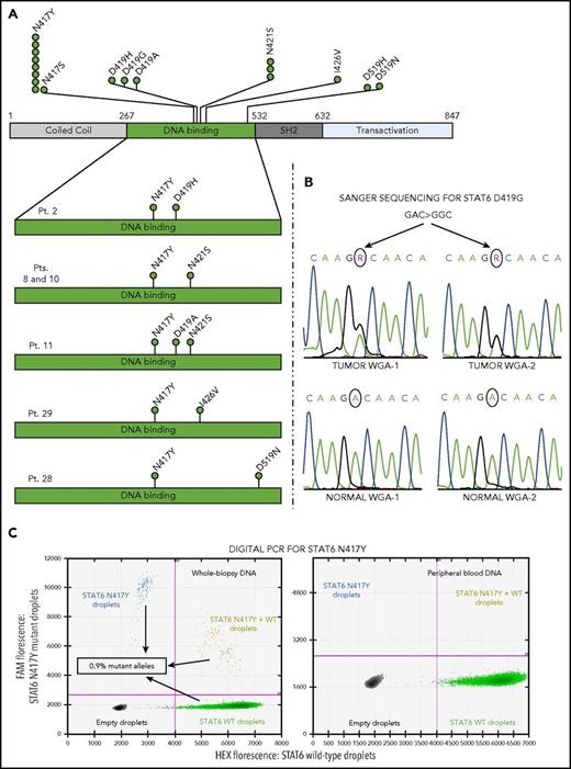 Figure 2. STAT6 mutations in cHL. (A) Secondary structure of the STAT6 protein, with the mutations found in cHL cases (green circles) clustering in the DNA binding domain. The latter is enlarged below to depict individual STAT6 alleles from 6 patients each carrying multiple monoallelic STAT6 mutations. (B) Sanger-sequencing validation in 1 representative case confirms the presence of a heterozygous STAT6 mutation (D419G) in both tumor WGA-DNA duplicates, but not in matched normal WGA-DNA. (C) Digital polymerase chain reaction analysis allows the backtracking of a somatic N417Y mutation in the unamplified tumor DNA of case 14 extracted from whole-tissue sections of a lymph node biopsy (left), but not in the DNA of a peripheral blood sample analyzed as a negative control (right); the same mutation had been originally identified by WES in the WGA-DNA of microdissected tumor vs normal cells. The low variant allele frequency (0.9%) reflects the known paucity of cHL tumor cells in the involved tissues (see supplemental Table 6 for the full results of digital polymerase chain reaction validation).