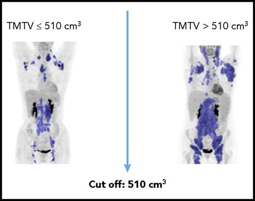 Examples of TMTV. Figure provided by M. Meignan.