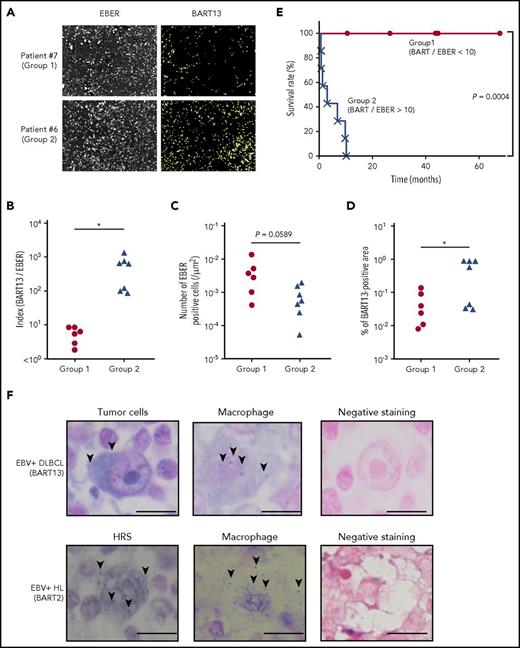 Figure 7. Amounts of tumor-produced BART miRNAs in EBV+DLBCL in elderly patients. (A) EBV-encoded noncoding RNA (EBER) served as a highly sensitive marker to detect EBV infection. EBER and BART13 were detected from DLBCL biopsy samples by fluorescence in situ hybridization. Representative results are shown. The definition of group 1 (n = 6) and 2 (n = 7) is indicated in B. (B) Comparison of the index of BART13+ area/number of EBER+ cells. Group 1, BART/EBER <10; gGroup 2, BART/EBER >10. *P < .05. (C-D) The numbers of EBER+ cells and BART13+ cell areas were automatically counted. Comparison of the number of EBER+ cells (C) and BART13+ cell areas (D) in the tissue area on a slide. *P < .05. (E) Survival ratio of patients with DLBCL. *P = .0004, log-rank test. (F) BART miRNAs were detected from EBV+ DLBCL (top) and EBV+ Hodgkin’s lymphoma (bottom) biopsy samples by in situ hybridization. (Left) Tumor cells; (middle) macrophages; (right) negative staining (using scramble miRNAs for the probe). (Top) BART-13 was detected; (bottom) BART-2. Representative BART miRNA signals (blue dots) are indicated by arrows. Scale bar, 10 μm.