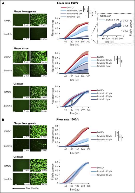 Figure 2. Ibrutinib inhibits plaque-induced, but not collagen-induced, platelet aggregate formation under arterial flow at shear rates of 600/s and 1500/s. Blood samples were incubated with DiOC6 for platelet labeling and with solvent control or ibrutinib for 15 minutes. (A) Perfusion at 600/s (calculated shear stress 19 dyn/cm2). Representative micrographs show the effect of DMSO (0.1%) or ibrutinib (1 µM) on platelet deposition onto plaque homogenate, plaque tissue sections, and collagen at 0 and 5 minutes after the start of blood flow (left panels). They also show the formation of platelet aggregates in controls and their inhibition by ibrutinib. Effect of ibrutinib on the kinetics of plaque- and collagen-induced platelet deposition (right panels). Residual plaque-induced platelet deposition with 1 µM ibrutinib is shown at an enlarged scale. (B) Perfusion at 1500/s (calculated shear stress 48 dyn/cm2). Representative micrographs show the effect of DMSO (0.1%) or ibrutinib (0.5 µM) on platelet deposition onto plaque homogenate and collagen at 0 and 5 minutes after the start of blood flow (left panels). Effects of ibrutinib (0.2 and 0.5 µM) on the kinetics of plaque- and collagen-induced platelet deposition (right panels). Data are mean ± SD (n = 5). Statistical significance at 5 minutes after the start of blood flow is indicated. Scale bars = 100 μm. *P < .05, **P < .01, ***P < .001.
