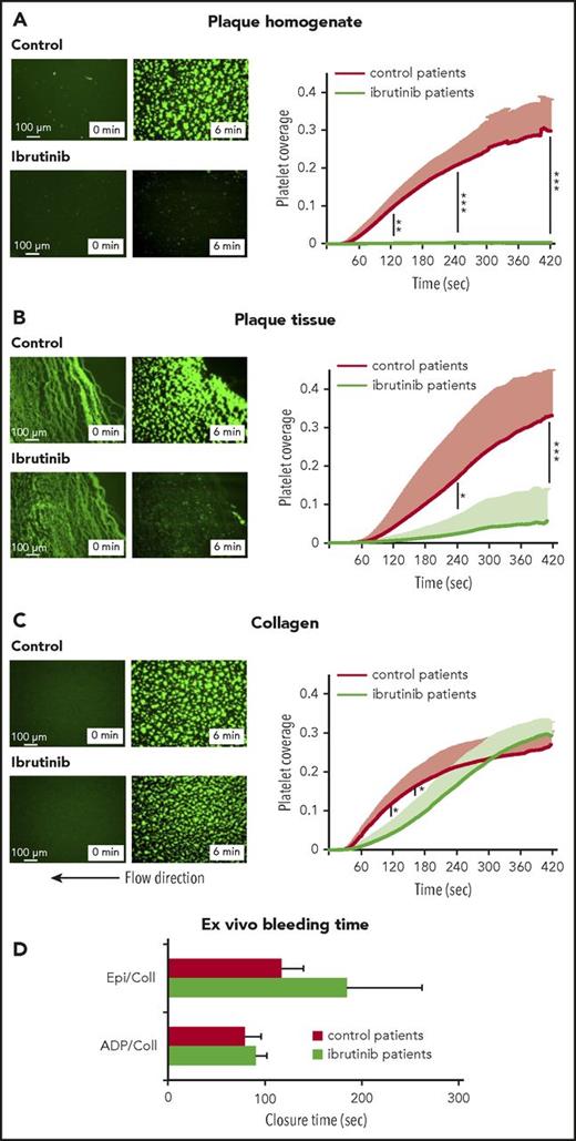 Figure 5. Inhibition of platelet thrombus formation on atherosclerotic plaque, but not collagen, under arterial flow in patients treated with ibrutinib. Representative micrographs show platelet coverage of plaque homogenate (A), plaque tissue sections (B), and collagen (C) at 0 and 6 minutes after the start of flow (shear rate 600/s) with blood from ibrutinib-treated patients and control patients (left panels). Effects of ibrutinib treatment on the kinetics of plaque- and collagen-induced platelet deposition (right panels). Data are mean + SD (n = 5). (D) Effect of oral ibrutinib treatment on bleeding time in vitro (PFA-100). Blood samples from 5 patients treated with ibrutinib and 5 control patients were transferred to epinephrine/collagen (Epi/Coll) or ADP/collagen (ADP/Coll) cartridges, and the in vitro CT was measured with a PFA-100 platelet function analyzer. Data are mean + SD (n = 5). *P < .05, **P < .01, ***P < .001.