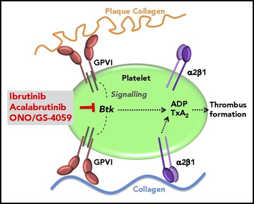 Figure 7. Model of the plaque-selective inhibition of platelet thrombus formation by Btk inhibitors. TxA2, thromboxane A2.