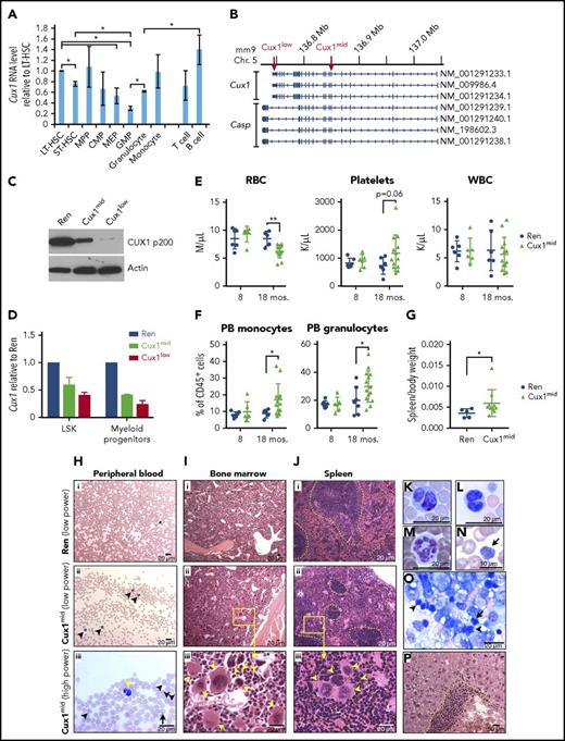 Figure 1. Description of CUX1 knockdown mouse models and characterization of MDS in Cux1mid mice. (A) Cux1 has cell type–specific expression levels. Cells were sorted as follows from the BM of wild-type C57BL/6 mice: LT-HSC (LSK+/CD34−/Flt3−), ST-HSC (LSK+/CD34+/Flt3−), MPP (LSK+/CD34+/Flt3+), CMP (Lin−/Sca1−/c-Kit+/CD34+/CD16/32low), MEP (Lin−/c-Kit+/Sca1−/CD34−/CD16/32−), and GMP (Lin−/c-Kit+/Sca1−/CD34+/CD16/32high). The following cells were sorted from the spleen: granulocytes (CD11b+/Gr1+), monocytes (CD11b+/Gr1−), B cells (B220+), and T cells (CD3+). qRT-PCR for Cux1 mRNA was performed. The data represent the mean ± SEM from 4 biological replicates. *Student t test, P < .05. (B) The Cux1 genomic locus is shown with all 7 RefSeq mRNA isoforms. shRNA (Cux1low and Cux1mid) targeting the indicated exons (red arrows) were used to generate transgenic mice. (C) A representative immunoblot for CUX1 protein in thymocytes isolated from Cux1low, Cux1mid, and Ren mice after 7 days of dox. The mean ± SD level of residual CUX1 protein quantified from 4 biological replicates for Cux1low was 12% ± 9% and 54% ± 17% for Cux1mid. (D) Cux1 mRNA level in sorted populations from Cux1mid and Cux1low BM compared with Ren littermate control. One representative replicate of 3 biological replicates is shown. LSK are Lin−/c-Kit+/Sca1+), and myeloid progenitors are Lin−/Sca1−/c-Kit+. (E) At 6 to 10 weeks of age, Cux1mid and Ren littermate control mice were started on continuous dox treatment and monitored for up to 18 months. Complete blood counts of mice at 8 and 18 months of dox are shown. (F) Flow cytometric analysis of peripheral blood (PB) samples for monocyte (CD11b+/Gr1−) and granulocyte (CD11b+/Gr1+) populations at 8 and 18 months of dox treatment. (G) Spleen weights after 18 months of dox. The mean ± SD is shown. *P ≤ .05, **P ≤ .01, Wilcoxon rank test. (H-P) Representative morphology images are shown for mice after 18 months of dox. (H) Wright-Giemsa staining of the peripheral blood in (Hi) Ren and (Hii-iii) Cux1mid mice. (Hii) Cux1mid mice have an increase in circulating mature granulocytes (arrowheads). (Hiii) A granulocyte with pseudo Pelger-Huet anomaly is shown (yellow arrowhead). Red blood cells in Cux1mid mice have increased Howell-Jolly bodies (arrow) and increased reticulocytes with basophilic stippling (black arrowheads). (Ii-ii) H&E staining of the bone marrow of aged Cux1mid mice shows a marked increase in megakaryocytes. (Iiii) At high power, clusters of megakaryocytes (arrowheads) with dysplastic features can be appreciated, including micromegakaryocytes, nuclear hypolobation, and condensed, hyperchromatic nuclei. (Ji-ii) H&E staining shows an expansion of the red pulp at the expense of the white pulp. The white pulp is outlined by a yellow dashed line for clarity. (Jiii) High-power analysis of Cux1mid spleens illustrates increased megakaryocytes (arrowheads) with some micromegakaryocytes with condensed, hyperchromatic nuclei. (K-L) Additional examples of peripheral blood granulocytes with pseudo Pelger-Huet anomaly. (M) Neutrophil with hypersegmentation. (N) A representative giant platelet is shown (arrow). (O) Touch preparation of Cux1mid spleen reveals erythroid dysplasia as evidenced by binucleated erythroblasts (arrowheads) and abnormal nuclear contours (arrow). (P) H&E staining shows a myelomonocytic cell infiltrate (dashed yellow line) in the liver of Cux1mid mice. Images were taken with a Zeiss Axioskop microscope. Chr, chromosome; H&E, hematoxylin and eosin; mRNA, messenger RNA; PB, peripheral blood; SD, standard deviation; SEM, standard error of the mean.