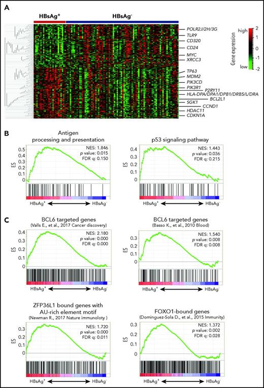 Figure 7. HBsAg+ DLBCLs displays a distinctive gene expression pattern. (A) HBsAg+ DLBCLs showed a distinctive gene expression profiling. The normalized expression levels were analyzed using the Qlucore Omics Explorer software. Significantly and differentially expressed genes (P < .05) between HBsAg+ (n = 24) and HBsAg− (n = 84) DLBCLs were used to draw the heatmap. (B) GSEA revealed pathway alterations in HBsAg+ DLBCLs compared with that in HBsAg− DLBCLs. The GSEA was performed with 1000 sample permutations. Enrichments were considered significant at false discovery rate q < 0.25. (C) GSEAPreranked tool was used to analyze BCL6 core transcriptional signatures (120 genes,47 BCL6 targeted genes derived from DLBCL,48 ZFP36L1-bound genes,44 and FOXO1-targeted genes49 along the preranked genes differentially expressed in HBsAg+ vs HBsAg− DLBCLs. Genes were preranked based on the correlation between the gene expression by comparing HBsAg+ and HBsAg− DLBCLs. The enrichment was tested with 1000 gene set permutations. Enrichments were considered significant at false discovery rate q < 0.05. ES, enrichment score; NES, normalized enrichment score.
