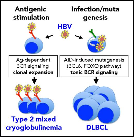 HBV might exploit 2 different mechanisms for causing either indolent (mixed cryoglobulinemia) or highly malignant (DLBCL) B-cell lymphoproliferative disorders. In the case of DLBCL, HBV infection of B cells may enhance overall mutagenesis (possibly through APOBEC enzymes) and alter B-cell–specific signaling pathways (possibly through AID). Among the latter, alterations in the FOXO pathway might result in lymphomagenic tonic B-cell receptor signaling. DLBCL cells do not seem to express stereotyped idiotypes putatively recognizing HBV antigens. Conversely, in mixed cryoglobulinemia, continual antigenic stimulation by HBV may drive the clonal expansion of B cells expressing specific stereotyped idiotypes that regress upon suppression of infection by antiviral therapy. There is no evidence suggesting the possibility of progression from mixed cryoglobulinemia to DLBCL.
