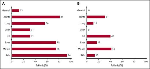 Figure 1. Sites of GVHD involvement. (A) The bar graph displays the percentage of all evaluable patients with specified organ involvement at baseline: 94% of patients had skin cGVHD involvement at baseline. (B) The bar graph displays the percentage of all evaluable patients with site-specific clinical improvement after 6 abatacept infusion: 42% of patients experienced improvement in mouth cGVHD after exposure to abatacept.