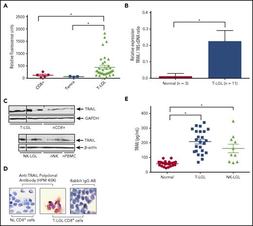 Figure 1. TRAIL is overexpressed in LGL leukemia. (A) TRAIL gene expression levels in PBMC from T-LGL patients (triangles; n = 37), CD8+ cells from normal subjects (circles, n = 5), and Temra cells from normal subjects (squares, n = 3) in the GSE42664 Affymetrix data set.18 (B) Quantitative real-time PCR was performed to measure levels of TRAIL mRNA in CD8+ cells from T-LGL patients (n = 11) or purified CD8+ from normal donors (n = 3). Relative TRAIL mRNA expression was normalized to 18S. Data are presented as mean ± SEM. *P < .05 indicates significant difference between LGL leukemia patients and normal donors (Student t test). (C) Immunoblot analysis of TRAIL protein in purified CD8+ cells from patients with T-LGL leukemia (n = 6) vs CD8+ cells from normal (n) donors (n = 6) and purified NK cells from patients with NK-LGL leukemia (n = 4) vs purified NK cells isolated from normal donors (n = 4) and PBMCs from normal donors (n = 2). Loading of protein was confirmed by probing for GAPDH or β-actin. Vertical lines within the leukemic groups indicate regions where samples were removed from the image based on poor protein extract quality as indicated by loading controls. (D) CD8+ cells from a T-LGL patient or normal (NL) donor were stained with TRAIL antibodies and visualized using light microscopy (original magnification ×400). Rabbit IgG antibody was used as a negative control. Data are representative of 3 experiments conducted with cells from 3 independent patients. (E) Serum levels of TRAIL were determined using an ELISA assay. Sera were tested from T-LGL leukemia patients (squares, n = 24; ANOVA, *P < .0001 T-LGL vs normal donor), NK-LGL leukemia patients (triangles, n = 10; ANOVA, *P < .0001, NK-LGL vs normal donor), or normal donors (circles, n = 24). cDNA, complementary DNA.