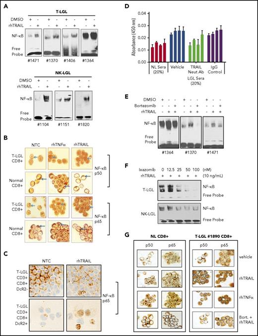 Figure 3. TRAIL induces NF-κB activation and nuclear translocation in LGL leukemia cells that are blocked by proteasome inhibitors. (A) EMSA demonstrating NF-κB activity in nuclear extracts from T-LGL patient PBMCs (n = 4) and NK-LGL patient PBMCs (n = 3) treated with either saline or rhTRAIL (10 ng/mL) for 2 hours. (B) NF-κB p50 or p65 protein ICC staining as visualized by light microscopy in CD8+ cells from an LGL leukemia patient compared with CD8+ cells from a normal donor (original magnification ×1000). Cells were treated with control (NTC), TNF-α (positive control, 10 ng/mL), or rhTRAIL (10 ng/mL). Brown staining represents NF-κB p50 or p65 protein. Data are representative of 3 experiments conducted with cells from 3 independent patients. (C) NF-κB p65 protein ICC staining as visualized by light microscopy in CD3+/CD8+/DcR2− and CD3+/CD8+/DcR2+ cells from an LGL leukemia patient (original magnification ×400). Cells were treated with either vehicle control (NTC) or rhTRAIL (10 ng/mL). Brown staining represents NF-κB p65 protein. Data are representative of experiments conducted with cells from 2 independent patients. (D) NF-κB p50 ELISA of PBMC nuclear protein extracts from T-LGL leukemia patients (n = 4) that were treated with sera from normal donor or sera from LGL patients. Patient cells treated with LGL sera were cotreated with vehicle, TRAIL neutralizing antibody (Neut Ab), or IgG control antibody. (E) EMSA demonstrating NF-κB activity in nuclear extracts from T-LGL patient PBMCs (n = 3) treated with vehicle (DMSO), rhTRAIL (10 ng/mL), or TRAIL (10 ng/mL) plus bortezomib (5 nM). (F) EMSA demonstrating NF-κB activity in nuclear extracts from patient cells from a T-LGL or NK-LGL patient treated with rhTRAIL (10 ng/mL) or rhTRAIL (10 ng/mL) plus increasing doses of ixazomib (0-100 nM). (G) NF-κB p50 or p65 protein ICC staining as visualized by light microscopy in CD8+ cells from normal control or LGL leukemia (original magnification ×400). Cells were pretreated with either bortezomib (5 nM) or DMSO for 2 hours followed with the treatment of rhTRAIL (10 ng/mL) or rhTNF-α (10 ng/mL positive control). Brown staining represents NF-κB p50 or p65 protein. Data are representative of 3 experiments conducted with cells from 3 independent patients.