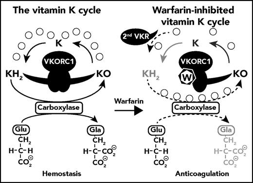 Inhibition of the vitamin K cycle by warfarin. KH2 is converted to KO during the carboxylation of Glu to Gla residues by γ-glutamyl carboxylase. Under normal physiologic conditions in the liver, VKORC1 efficiently recycles KO back to KH2 in a 2-step reaction, generating K as an intermediate product (left side). The uncoupling of the 2 VKORC1-mediated reactions (KO→K and K→KH2) in the presence of warfarin, as described by Rishavy et al, causes a loss in efficiency of VKORC1 for the full recycling of KO to KH2 and a loss in carboxylation. However, because warfarin uncouples the reaction rather than directly inhibits the reaction, VKORC1 can still generate considerable amounts of the K intermediary. The completion of the final step (K→KH2) then becomes dependent on the extent to which the second warfarin-resistant vitamin K quinone reductase (2nd VKR) is present and active. Thus, although VKORC1 is responsible for the full recycling of KO to KH2 in the absence of warfarin, the recycling pathway changes in the presence of warfarin and requires cooperation of VKORC1 and the 2nd VKR.3 The degree of carboxylation in the presence of warfarin is therefore dependent on the expression and activity of 2nd VKR (indicated by the dotted arrows), the identity of which remains unknown to date.