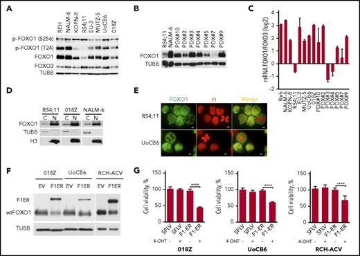 Figure 1. Expression of FOXO1 in BCP-ALL. (A) Expression of FOXO1 and FOXO3A proteins and phosphorylation of FOXO1 in BCP-ALL cell lines analyzed by immunoblot. (B) Expression of FOXO1 in PDX ALL analyzed by immunoblot. (C) Relative expression of FOXO1 and FOXO3A mRNA in BCP-ALL cell lines and PDX ALL samples. FOXO1 and FOXO3 mRNA expression was analyzed by quantitative reverse transcription polymerase chain reaction (qRT-PCR). The log2 of FOXO1/FOXO3A ratio was calculated as CtFOXO3a-CtFOXO1, where Ct is cycle threshold. Data are shown as mean ± SD (N = 3). (D) Subcellular distribution of FOXO1. After subcellular fractionation, expression of FOXO1 was detected by immunoblot; purity of cytoplasmatic and nuclear fractions was controlled by expression of tubulin B (TUBB) and histone 3 (H3), respectively. (E) Immunofluorescence analysis of FOXO1 localization in BCP-ALL cell lines. Cells were attached to the surface of glass slides by low-speed centrifugation and stained by anti-FOXO1 antibody (green). Nuclei were counterstained with PI (red). Images were acquired using a Zeiss MTB2004 system using Axiovision software (63× oil immersion lens, original magnification ×228). (F) Expression of inducible constitutive-active FOXO1 (FOXO1(3A)ER in BCP-ALL cell lines (F1ER) and wild-type FOXO1 (wtFOXO1). (G) FOXO1 activation is toxic for BCP-ALL cell lines. Pre-BCR+ (018Z and RCH-ACV) and Pre-BCR− (UoCB6) cell lines transduced with FOXO1(3A)ER or with control vector were sorted and treated with 200 nM 4-OHT. After 48 hours, live cells were counted using trypan blue exclusion. The data are presented as percentage of control nontreated cells (mean ± SD). The significance by 2-sided Student t test (N = 3). ****P < .0001.