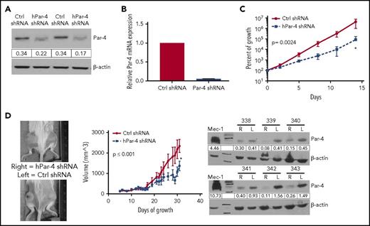 Figure 4. Par-4 knockdown in Mec-1 CLL cells results in reduced growth in vitro and in vivo. (A) Western blot showing a reduction in Par-4 in Mec-1 cells expressing Par-4–specific shRNA. Par-4 protein values were normalized to β-actin. (B) Par-4 mRNA is decreased in Mec-1 cells expressing Par-4 shRNA compared with those expressing a control shRNA. Par-4 mRNA expression was normalized to human 18S and was measured in triplicate. (C) Growth curve of Mec-1 cells expressing control or Par-4–specific shRNA. Curves represent an average of 4 control and 4 Par-4 shRNA-treated clones. Slopes of the curves are different (P = .0024) as calculated by linear regression analysis. (D) Mec-1 cells (2 × 106) treated with control or Par-4–specific shRNA lentivirus were engrafted into NSGS mice (n = 6) subcutaneously with Matrigel. Images represent 2 mice of 6 after 35 days of growth (left). Tumor volumes are plotted as a function of time (middle panel). Tumor volumes were calculated by measuring length and width with a caliper. Difference between the slopes of the 2 lines was found to be statistically significant (P ≤ .001) by linear regression analysis. After 35 days of growth, the tumors were excised and western blot analysis was performed to confirm tumors retained Par-4 knockdown in each mouse throughout the experiment (right panel). The numbers above blots refer to individual mice. Error bars represent SEM. L, left; R, right.