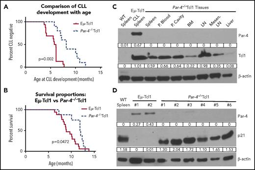 Figure 6. Loss of Par-4 in the Eμ-Tcl1–transgenic mice delays CLL growth and increases survival. Leukemic status in Par-4+/+ and Par-4−/− EµTcl1 mice was measured by staining of peripheral blood lymphocytes for CD5+CD19+ cells. Animals died of natural progression of disease or were euthanized due to poor body conditions for humane reasons. (A) Percentage of CLL cases detected with age of Par-4+/+Tcl1 and Par-4−/−Tcl1 cohorts over time. P = .0002 comparing the 2 curves by log-rank test (n = 16, Par-4+/+Eμ-Tcl1; n = 10, Par-4−/−Tcl1). (B) Effect of Par-4 loss on the survival of Eµ-Tcl1 mice. Survival curve represents a total of 17 Par-4+/+ Tcl1 mice and 9 Par-4−/−Tcl1 mice. P = .0472 comparing the 2 curves by log-rank test. (C) Tissues from Par-4−/−Tcl1 mice were harvested and expression of Par-4 and Tcl1 proteins was determined by western blot analysis. Par-4 was detected in the spleen of Par-4+/+Tcl1 mouse, but was not present in any of the tissues of the Par-4−/−Tcl1 mouse. (D) Spleens from multiple Eμ-Tcl1 mice and Par-4−/−Tcl1 mice were harvested and total protein was isolated. Immunoblots were probed for Par-4 and p21. Protein expression was normalized to β-actin. LN, lymph node; Mesen. LN, mesenteric lymph node.