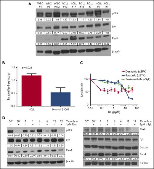Figure 7. Primary human CLL cells have high levels of Par-4 protein expression. (A) Immunoblot analysis of activated SFK and Par-4 protein expression levels in primary human CLL (hCLL) samples compared with the whole peripheral blood lysate of normal donors (WBC). Protein values are normalized to β-actin. (B) Cell lysates of purified B cells from CLL patients (n = 4) and from healthy donors (n = 4) were probed for Par-4. The bar graph represents Par-4 protein values normalized to GAPDH expression. P = .022 determined by Student t test. (C) Survival curves of hCLL cells treated with BCR-signaling inhibitors. Assay performed in triplicate. Error bars represent SEM. (D) Primary human peripheral blood CLL cells (97.7% CD5+CD19+) were treated with 1 μM dasatinib (left) and 5 μM fostamatinib (right). p-SFK and Syk levels are normalized to their respective total protein levels. Total Syk, Lyn, and Par-4 protein expression levels are normalized to β-actin.