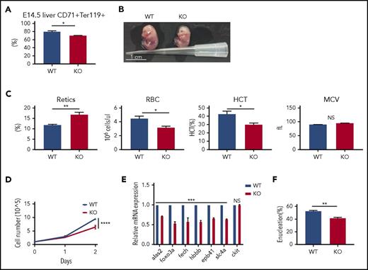 Figure 2. mPHOSPHO1 is essential for fetal erythropoiesis. (A) Smaller percentages of CD71+Ter119+ erythroblasts in E14.5 KO mouse livers. Mature red cells in fetal livers were lysed and cells were stained with anti-CD71 and anti-Ter119 antibody (n = 9 fetal livers from 3 mice per group, mean + SEM). (B) Photographs of E14.5 WT and KO embryos. (C) Complete blood counts of 0.5-day WT and KO neonates (n = 7 per group, mean + SEM). (D) Lower growth rate in erythroblasts depleted of mPHOSPHO1. E14.5 fetal liver lineage-negative cells were isolated from WT and PHOSPHO1-KO mice, expanded in maintenance medium for 1 day, and cultured in differentiation medium for 2 days (n = 3 per group, mean ± SEM). Cells were counted during the 2 days of differentiation. (E) Gene expression of WT and KO erythroblasts after 1 day differentiation (n = 3 per group, mean + SEM). mRNA expression is plotted relative to expression of 18s rRNA. (F) Enucleation is lower in KO erythroblasts after 2 days of differentiation (n = 3 per group, mean + SEM). HCT, hematocrit; NS, not significant.