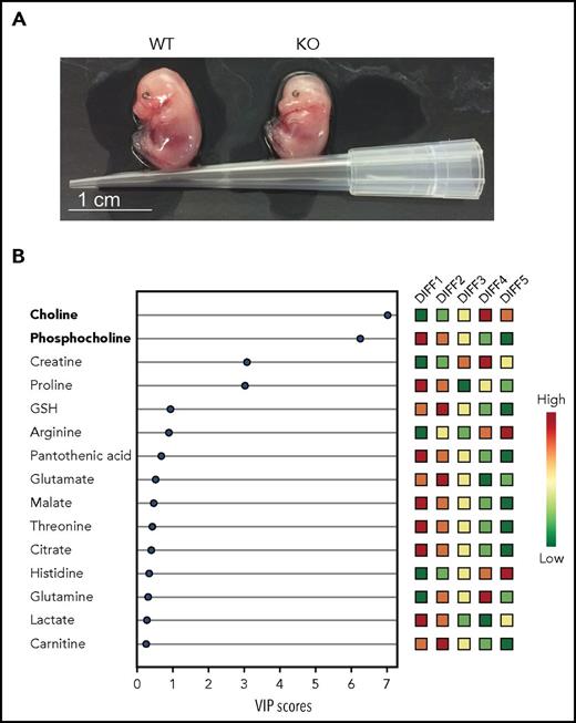 Changes in lipid metabolism are essential for terminal erythropoiesis in mice and humans. (A) Photographs of E14.5 WT and PHOSPHO1 KO mice showing impaired growth and pallor of the mutants, highlighting the importance of phosphocholine metabolism in later red cell maturation. (B) Human CD34+ cells differentiated using a 5-stage in vitro culture, following which lipid metabolites were extracted and analyzed. Relative amounts of polar metabolites (colored boxes, right) with VIP scores (bottom) indicate loss of phosphocholine and increase in choline toward the end of erythroid differentiation. VIP, variable importance in projection; WT, wild-type. See Figures 2B and 6A in the article by Huang et al that begins on page 2955.