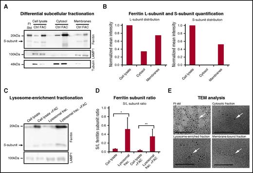 Figure 2. Iron-loaded ferritin is located in membrane-bound vesicles, specifically in lysosome-enriched fractions. (A) Control and iron-treated (100 μg/mL FAC for 24 hours) BMDMs were fractionated using a differential subcellular fractionation method. Total cell lysates and cytosol and membrane-bound vesicle–enriched subfractions (membranes) were separated on SDS-PAGE (40 µg protein/lane) and analyzed by western blot, with anti-l-ferritin, LAMP1 (lysosomal marker), and antitubulin (cytosolic marker) antibodies. The results of 1 out of 3 representative experiments are shown. (B) Intensity of L- and S-ferritin bands of control (Ctrl) samples were quantified using Adobe Photoshop software. Mean band intensities were normalized to whole-cell protein by volume ratios. The results of 1 out of 3 representative experiments are shown. (C) Control and iron-treated (100 μg/mL FAC for 24 hours) RAW264.7 macrophages were fractionated using a lysosomal enrichment method. Total cell lysates and lysosomal fractions were separated on SDS-PAGE and analyzed by western blot with anti-l-ferritin and anti-LAMP1 antibodies. (D) Intensity of L- and S-ferritin bands on immunoblot was quantified; each bar represents mean ± standard deviation (SD); n = 4 (*P < .05, **P < .01 compared with control samples). (E) A drop of each fraction was mounted on a carbon-coated copper grid at room temperature. Iron cores (arrows) were determined using a JEOL (JEM-2100) electron microscope operated at 200 KeV. Scale bar represents 100 nm.