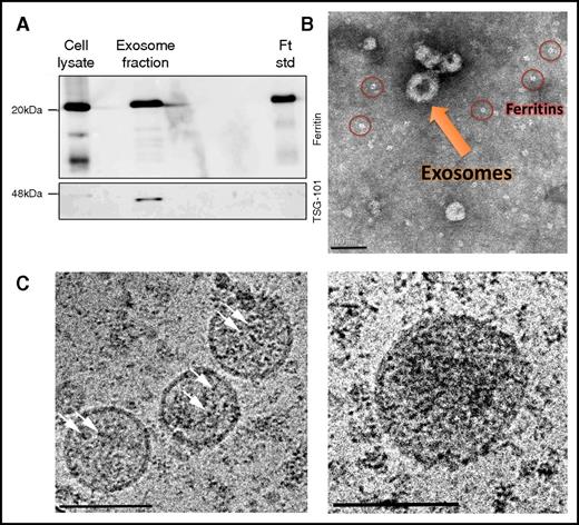 Figure 6. Ferritin-iron cores are present in exosomes. (A) RAW264.7 macrophages were incubated for 24 hours in a mixture of OptiMEM I medium and Dulbecco’s modified Eagle medium (1:1 volume ratio) supplemented with 10% heat-inactivated fetal bovine serum, 2 mM l-glutamine, 100 U/mL penicillin, 100 μg/mL streptomycin, 1 mg/L BSA, 20 mM β-mercaptoethanol, and 100 μg/mL FAC. To precipitate exosomes, cells were harvested, and medium was collected and centrifuged at 100 000g for 1.5 hours. Samples were then separated by SDS-PAGE and analyzed by western blot with anti-ferritin L-subunit and anti-TSG101 (serving as exosomal marker) antibodies. The results of 1 out of 4 experiments are shown. (B) Exosomal samples were resuspended in 0.1% Glutaraldehyde, and a drop was mounted on an ion-coated copper grid supported by a carbon-coated film. The sample was stained with 1% uranyl acetate and visualized by TEM. Scale bar represents 100 nm. (C) Exosomal samples were captured by cryo-TEM. Vitrified unstained specimens were loaded to a Tecnai T12 G2, operating at 120 kV, and examined at a low dose to minimize radiation damage. The arrows point to iron cores. Scale bars represent 100 nm.