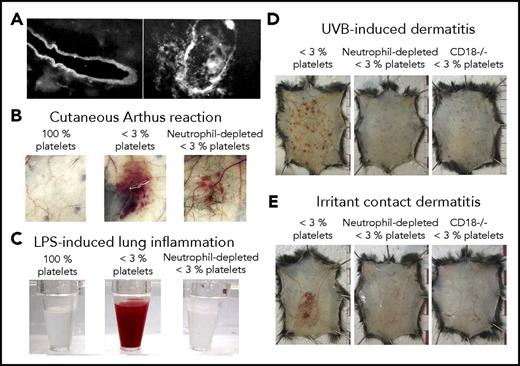 Figure 4. Platelets are required to seal vascular injuries inflicted by infiltrating leukocytes. (A) Immunostaining of the basement membrane of skin vessels before (left) and after (right) neutrophil transmigration had occurred during the cutaneous Arthus reaction in a rabbit. Adapted from Cochrane and Aikin68 with permission. (B-C) Representative photographs showing the aspect of the skin after 4 hours of cutaneous reverse passive Arthus reaction (B) or of the bronchoalveolar lavage fluid collected after 24 hours of LPS-induced lung inflammation (C), in control mice (100% platelets) and in mice that were immunodepleted for platelets alone (<3% platelets) or for platelets and neutrophils (neutrophil-depleted <3% platelets). Note that in both inflammatory models, neutrophil depletion before the reaction led to the prevention of inflammatory bleeding. (B) Adapted from Gros et al34 with permission. (C) Adapted from Hillgruber et al20 with permission. (D-E) Representative photographs showing that thrombocytopenic mice depleted for neutrophils or with defective neutrophil recruitment to the inflamed skin because of a genetic deficiency beta2 integrin (CD18−/−) are protected toward ultraviolet B radiation- or irritant contact dermatitis-induced petechial skin bleeding. Adapted from Hillgruber et al20 with permission.