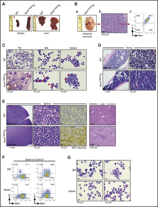 Figure 3. A fraction of Asxl1Y588XTg mice developed myeloid leukemia. (A) The gross appearance of spleen and liver of a WT mouse and a representative Asxl1Y588XTg mouse with leukemia. (B) Photographs of a sarcoma from a leukemic Asxl1Y588XTg mouse (left), histological (middle), and flow cytometric (right) analyses showed the predominant granulocytic/monocytic (Gr-1+/Mac1+) cells in the sarcoma. Bar represents 100 µm. (C) May-Giemsa–stained PB smears, BM, and spleen cell cytospins prepared from representative WT (top) and Asxl1Y588XTg mice (bottom). Red arrow, blast cells. Bars represent 10 µm. (D,E) H&E-stained sections of femurs (D), H&E- and MPO-stained spleens (E, left), and H&E-stained livers (E, right) from representative WT (top) and Asxl1Y588XTg mice (bottom). Bars represent 1 mm, 10 µm, 100 μm. (F) Flow cytometric analysis of cKit+/Mac1+ or Gr-1+/Mac1+ cells in the BM and spleen cells of representative recipient mice transplanted with spleen cells from a leukemic Asxl1Y588XTg mice. Cells were gated on CD45.2+. (G) May-Grünwald-Giemsa–stained cytospins of the BM and spleen cells from representative recipient mice transplanted with spleen cells from a leukemic Asxl1Y588XTg mice. Bars represent 10 µm.