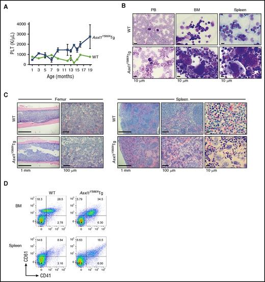 Figure 4. A fraction of Asxl1Y588XTg developed MPN. (A) Assessment of platelet (PLT) levels in PB from Asxl1Y588XTg mice (n = 39) and WT littermates (n = 16) at various ages. (B) May-Grünwald-Giemsa–stained PB smears, cytospins of BM and spleens from representative WT (top), and Asxl1Y588XTg mice with MPN (bottom) are shown. Bar represents 10 µm. (C) H&E–stained sections of femurs and spleens from representative WT (top) and Asxl1Y588XTg mice with MPN (bottom) are shown. Bars represent 1 mm, 10 μm, or 100 μm. (D) Representative flow cytometric analysis of CD41+/CD61+ cells in BM and spleen cells of WT littermate (left) and Asxl1Y588XTg mice with MPN (right).
