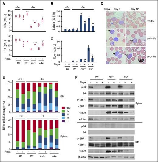 Figure 3. Suppression of elevated mTORC1 activity by rapamycin attenuates IE of iron-deficient Hri−/−, eAA, and Atf4−/− mice. (A) CBC analysis of blood samples after 12 days of vehicle or rapamycin (Rapa) treatments. (B) Spleen weights as percentage of body weight. (C) Serum Epo levels. P values denote the comparison between vehicle and rapamycin treatment of each genotype. *P < .05, **P < .01, ***P < .001. (D) Representative blood smears before (day 0) and after 12 days (day 12) of rapamycin treatments. Arrows indicate globin inclusions. (E) Erythroid differentiation of BM and spleen. (F) mTORC1 activity in total BM and spleen cells. Numbers of mice used in (A-C and E), +Fe conditions: Wt, n = 3; Wt+rapa, n = 3; –Fe conditions: Wt, n = 5; Wt+rapa, n = 4; Hri−/−, n = 4; Hri−/−+rapa, n = 5; eAA, n = 4; eAA+rapa, n = 5.