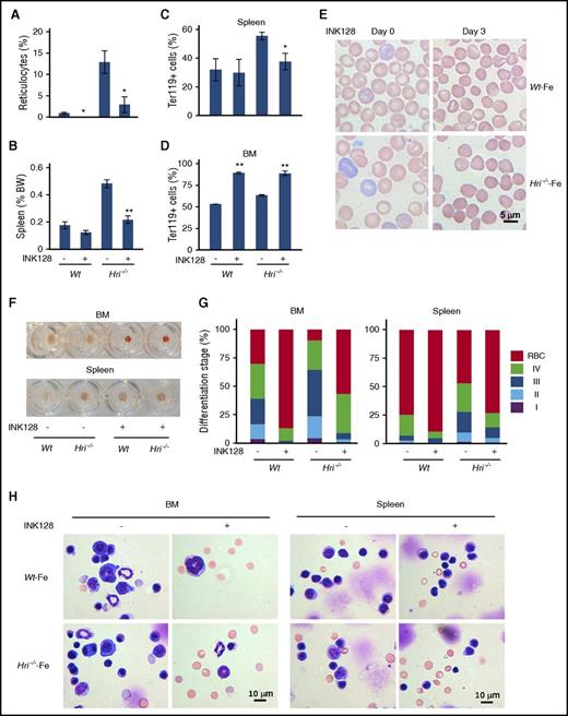 Figure 4. INK128 reduces IE of Hri−/−–Fe mice. (A) Reticulocyte percentage in blood samples and (B) spleen weights of Wt–Fe and Hri−/−–Fe mice treated with vehicle or INK128 for 3 days. (C-D) Percentages of Ter119+ cells in spleens and BM. P values denote the difference between vehicle and INK128 treatment of each genotype. *P < .05, **P < .01. (E) Representative Wright-Giemsa stained blood smears before (day 0) and after 3 days (day 3) of INK128 treatment. (F) Representative cell pellets of BM and spleen samples. (G) Erythroid differentiation of BM and spleen. (H) Representative cell morphology of BM and spleen samples stained with May-Grunwald-Giemsa. Three mice were used for each condition and genotype.
