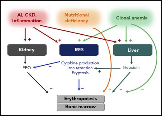 Figure 2. Possible mechanisms of anemia in older adults. A hyperinflammatory state is typical in anemia of inflammation (AI), CKD, and inflammaging. This state is characterized by increased hepcidin production in the liver, resulting in a direct negative impact on erythropoiesis and increased iron retention in the reticuloendothelial system (RES). Moreover, production of EPO is insufficient in response to anemia, and EPO response in the erythropoiesis is blunted. A further hallmark in the pathogenesis of AI is the increased phagocytosis of aging erythrocytes (eryptosis). Clonal disorders in leukocytes increase the risk of developing cardiovascular complications and anemia. This association may be caused by the promotion of inflammatory processes. Plus signs symbolize stimulation, and minus signs inhibition.