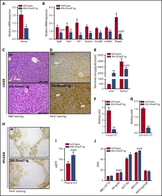 Figure 2. Iron overload phenotype in hepatocyte-specific Smad7-overexpressing mice. (A-B) Relative mRNA expression of hepcidin (Hamp) and several Tgf-β/Bmp target genes in the liver of Alb-Smad7-tg (n = 7) and control mice (n = 5), measured by quantitative real-time PCR. (C) Hematoxylin-and-eosin (H&E) staining (scale bar, 100 μm) and (D) Perls’ staining (scale bar, 20 μm) for iron depositions in liver of Alb-Smad7-tg and control mice. (E) Nonheme iron content in liver and spleen of Alb-Smad7-tg (n = 7) and control mice (n = 5). (F-G) Normalization of hepcidin and of phosphorylated Smad1 levels to liver iron in Alb-Smad7-tg and control mice. (H) Perls’ staining (scale bar, 50 μm) in the spleen of Alb-Smad7-tg and control mice. (I) Plasma iron levels in Alb-Smad7-tg mice (n = 7) compared with control mice (n = 3). (J) Hematological indices in Alb-Smad7-tg mice compared with control mice (n = 3 mice per group). Images are representative staining of 3 mice per group. Data were analyzed using GraphPad Prism software and results are shown as mean ± SEM. For the statistical analysis, a nonparametric distribution and the Mann-Whitney U test were used. *P < .05; **P < .005; ***P < .0005. Hb, hemoglobin; HCT, hematocrit; LIC, liver nonheme iron content; MCH, mean corpuscular hemoglobin; MCV, mean corpuscular volume; RBC, red blood cell.