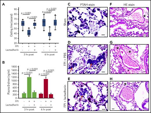 Figure 1. Lactadherin reduced TBI-induced coagulopathy and vasculopathy. Clotting time (A) and plasma d-dimer (B) of sham mice and FPI mice preconditioned with either PBS or lactadherin (n = 16, 1-way ANOVA). Representative images of PTAH-stained lungs from a sham mouse (C) and FPI mice receiving PBS (D, red arrow indicates extensive blue PTAH stain for intravascular fibrin deposition) or lactadherin (E, arrow indicates significantly reduced intravascular PTAH stain, bar in C-E = 10 μm). Representative images of H&E-stained lungs from a sham mouse (F) and FPI mice receiving PBS (G) or lactadherin (H, bar in F-H = 20 μm). Perivascular space (denoted with an asterisk) is enlarged with extravascular accumulation of erythrocytes (hemorrhage) in the lungs of TBI mice receiving PBS. The C-H images are representatives of the 26 mice examined.