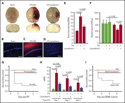 Figure 2. Lactadherin reduced cerebral edema and improved outcomes of FPI. (A) Representative topical and cross-sectional views of brains from a sham mouse (left) and from FPI mice preconditioned with PBS (middle) or lactadherin (right). (B-D) Representative fluorescence images of brain cryosections from a sham mouse and mice receiving lactadherin or PBS. (E) Levels (OD unite) of Evans blue in the supernatants of tissue homogenates from FPI mice receiving different treatments (n = 9, 1-way ANOVA). (F) Platelet counts at the baseline (white bars) and 3 hours after FPI (black bars) of sham mice and TBI mice preconditioned with PBS or lactadherin (n = 16, 1-way ANOVA). A Kaplan-Meier survival analysis (G, n = 18; P < .005 vs mice received PBS) and modified Neurological Severity Score (H, n = 18, 1-way ANOVA) of sham and FPI mice receiving PBS or lactadherin. (I) A Kaplan-Meier survival analysis of BDMV-infused and control mice (P < .005 vs mice that received PBS).