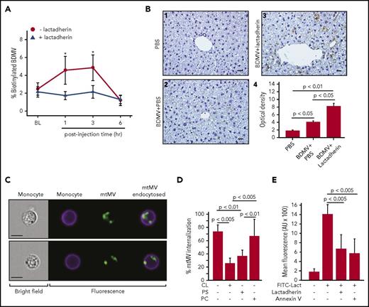 Figure 4. Lactadherin promoted BDMV clearance through phagocytosis. (A) Plasma levels of biotinylated BDMVs infused into noninjured mice that also received lactadherin or PBS (n = 12, paired t test; *P < .01). (B) Representative images of liver sections from mice infused with (1) PBS, (2) biotinylated BDMVs, and (3) biotinylated BDMVs with lactadherin were stained with horseradish peroxidase–conjugated streptavidin (bar = 20 μm, biotinylated BDMVs are stained in brown color); (4) integrated optical densities from scans from multiple mice (n = 9, 1-way ANOVA). (C) Bright field (left) and fluorescence images (right) of CD45+ monocytes and MitoTracker Green+ mtMVs (right overlay) detected by imaging flow cytometry. (D) mtMV binding to CD45+ monocytes in the absence and presence of PS, CL, and phosphatidylcholine (PC; all 200 nM, n = 12, 1-way ANOVA). (E) Blocking the binding of fluorescein isothiocyanate-lactadherin to BDMVs by 100-fold excess of either unlabeled lactadherin or annexin V (n = 24, 1-way ANOVA).