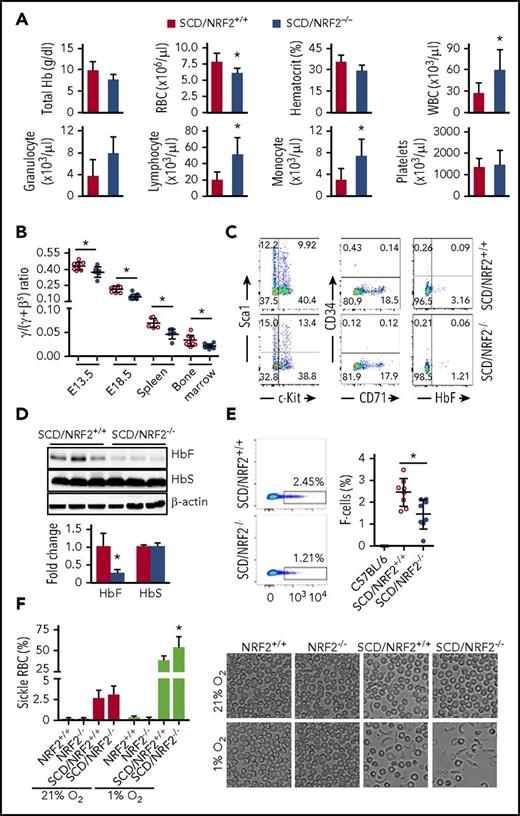 Figure 1. NRF2 loss decreased γ-globin gene transcription in SCD mice during gestation. SCD mice with homozygous NRF2 knockout (SCD/NRF2−/−) were established by crossbreeding Townes SCD mice13 and NRF2 knockout (NRF2−/−) mice14 (supplemental Methods; supplemental Table 1). (A) Hematological indices of 2- to 3-month-old SCD/NRF2+/+ (red bars) and SCD/NRF2−/− mice (blue bars) were analyzed by automated complete blood counts and differentials. (B) Expression of human γ-globin and adult βS-globin genes was monitored by qRT-PCR in embryonic day 13.5 and embryonic day 18.5 fetal livers and adult spleen and bone marrow (n = 6-8 mice per group); the γ/(γ+βS) mRNA ratios were calculated. Red circles, SCD/NRF2+/+ mice; blue circles, SCD/NRF2−/− mice. (C) Bone marrow hematopoietic progenitors were isolated from transgenic mice and used for analysis of the different proteins by flow cytometry (supplemental Methods). Representative scatter plots are shown. (D) The levels of HbF and HbS were determined by western blot analysis of whole-tissue protein extracts isolated from adult SCD/NRF2+/+ mice (red bars) and SCD/NRF2−/− mice (blue bars) spleens (n = 3) (top), and quantitative data were generated (bottom); β-actin was used as a loading control. (E) Flow cytometry analysis determined the percentage of HbF-positive RBCs (F-cells) in the peripheral blood stained with fluorescein isothiocyanate–conjugated HbF antibody; RBC gating was performed as described in supplemental Methods (supplemental Figure 2). Representative dot plots for F-cell distribution are shown (left), and the percentage of F-cells was quantified (right) (n = 8). Red circles, SCD/NRF2+/+mice; blue circles, SCD/NRF2−/− mice. C57BL/6 mice were non–sickle cell controls. (F) The level of RBC sickling in the peripheral blood was quantified under normoxic (21% O2) and hypoxic (1% O2) oxygen conditions (left); data represent the mean ± standard deviation (n = 6-7). Representative images under bright field are shown at ×600 magnification (right). *P < .05. qRT-PCR, quantitative reverse transcription polymerase chain reaction.