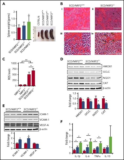 Figure 2. Loss of NRF2 function produced severe splenomegaly and inflammation in SCD mice. (A) The weight (left) and size (right) of spleens from NRF2 wild-type (+/+), heterozygote (+/−), and knockout (−/−) SCD mice were determined. (B) Histologic section of spleen tissue stained with hematoxylin and eosin is shown; scale bars: (i and ii), 100 µm; (iii and iv), 40 µm. (C) Using 2'-7'-dichlorodihydrofluorescein diacetate staining and flow cytometry, ROS levels in RBCs were determined (n ≥ 6); RBC gating was performed as described in supplemental Methods (supplemental Figure 2). (D) Western blot was completed to determine the expression of antioxidant proteins in spleen whole-tissue extracts for adult SCD/NRF2+/+ mice (red bars) and SCD/NRF2−/− mice (blue bars) (n = 3 per group) (top), and quantitative data were generated (bottom); β-actin was used as a loading control. (E) Western blot was completed as in panel D for the following: intercellular adhesion molecule 1 (ICAM-1), vascular cell adhesion molecule (VCAM-1), and vascular endothelial growth factor (VEGF-A) (top), and quantitative data analyzed (bottom). (F) The mRNA levels of the various genes shown were measured by qRT-PCR in spleen cells isolated from 2- to 3-month-old mice (n = 6 per group). Red bars, C57BL/6 mice; blue bars, SCD/NRF2+/+ mice; light green bars, SCD/NRF2−/− mice. The level of mouse 18s ribosomal RNA was used as an internal control. **P < .01; *P < .05. CAT, catalase; GCLC, γ-glutamylcysteine ligase catalytic subunit; HMOX1, heme oxygenase 1; NQO1, NAD(P)H quinone dehydrogenase 1; qRT-PCR, quantitative reverse transcription polymerase chain reaction.