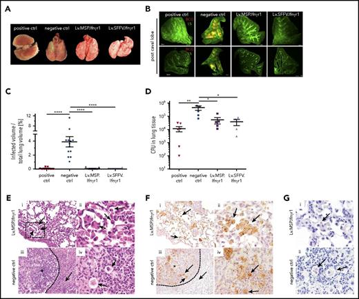 Figure 6. Preservation of lung structure after pulmonary BCG infection upon constitutive or myeloid-specific Ifnγr1 overexpression. (A) Representative macroscopic photos of lungs isolated from mice 9 weeks after infection (positive control, mouse that received WT cells; negative control, mouse that received Lv.GFP-transduced Ifnγr1−/− cells). (B) Representative light sheet microscopy photos of post caval lung lobes depicting the lung structure (LS; green) and infiltration of DsRed-labeled BCG (red) (positive control, mouse that received WT cells; negative control, nontransplanted Ifnγr1−/− mouse). Scale bars represent 500 μm. (C) Quantification of light sheet microscopy depicting the percentage of infected volume of the total lung volume. Mean and SEM are shown for 1 representative experiment (positive control, 9 mice that received WT cells; negative control, 13 nontransplanted Ifnγr1−/− mice; Lv.SFFV.Ifnγr1, n = 10; Lv.MSP.Ifnγr1, n = 9; one-way ANOVA using Tukey’s multiple comparisons post hoc testing). (D) BCG CFU counts of lung homogenates 9 weeks after infection. Mean and SEM (error bars) are shown for 2 independent experiments (positive control, 6 mice that received WT cells; negative control, 5 mice that received Lv.GFP-transduced Ifnγr1−/− cells and nontransplanted Ifnγr1−/− mice: Lv.SFFV.Ifnγr1, n = 4; Lv.MSP.Ifnγr1, n = 5; one-way ANOVA using Dunnett’s multiple comparisons post hoc testing). (E) Representative hematoxylin and eosin–stained histologic sections of lungs isolated 9 weeks after infection are shown for (i-ii) Lv.MSP.Ifnγr1 mouse and (iii-iv) negative control (mouse that received Lv.GFP-transduced Ifnγr1−/− cells). (i) Macrophages and multinucleated cells within the alveoli indicated by black arrows (original magnification ×200). (ii) Higher magnification of black box indicated in (i). (iii) Granuloma indicated by asterisk and macrophages and neutrophils surrounded by collagen fibers (dotted arrow) (original magnification ×200). (iv) Higher magnification photo of giant cells (black arrows). (F) Representative GFP-stained histologic lung sections isolated 9 weeks after infection are shown for (i-ii) Lv.MSP.Ifnγr1 mouse and (iii-iv) negative control mouse that received Lv.GFP-transduced Ifnγr1−/− cells. (i) GFP+ cells (brown signals) are distributed equally throughout Lv.MSP.Ifnγr1 mouse lung tissue and give rise to macrophages (black arrows; ×200). (ii) Higher magnification (×600) of GFP+ intra-alveolar macrophages. (iii) GFP+ cells are numerous in granulomas of negative control mice (*) and macrophages and neutrophils (black arrows) surrounded by collagen fibers (dotted arrow; ×200). (iv) Higher magnification (×600) photo of clustered GFP+ cells (black arrows). (G) Ziehl-Neelson staining of histologic lung sections indicating intracellular acid-fast bacteria (black arrows) (original magnification ×600 for i-ii). *P ≤ .05; **P ≤ .01; ****P ≤ .0001.