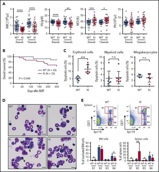 Figure 4. Abnormal dysplastic hematopoiesis in Srsf2 mutant-transplanted mice. (A) Complete blood cell (CBC) counts of the PB from WT and KI mice are plotted as dots. The mean ± SD are presented as bars. Data were obtained from 4 independent experiments. The numbers of mice analyzed were n = 45 (WT) and n = 41 (KI) at 8 weeks and n = 38 (WT) and 31 (KI) at 16 weeks after transplantation. (B) Kaplan-Meier survival curve of WT (n = 26) and KI (n = 23) mice at 300 days after transplantation. (C) Percentages of dysplastic erythroid cells, myeloid cells, and megakaryocytes are plotted; bars indicate mean ± SD. In total, 7 pairs of WT and KI mice were analyzed for morphological evaluation of erythroid and myeloid cells, and 5 pairs were analyzed for morphological evaluation of megakaryocytes. For each mouse, >200 erythroid cells, >100 myeloid cells, and >15 megakaryocytes were counted. (D) Representative May–Grünwald–Giemsa staining of BM cells is shown; arrows point to binucleated erythroid cells. Magnification 1000×; scale bar, 10 μm. (E) Upper panels: representative flow cytometry analysis of erythroid lineage in the spleen, showing CD71highTer119med (R1), CD71highTer119high (R2), CD71medTer119high (R3), and CD71lowTer119high (R4) gates. Lower panels: percentage of erythroid precursors in the BM and spleen cells (mean ± SD, n = 7). *P < .05; **P < .01; ***P < .001; ****P < .0001. BMT, bone marrow transplantation. KI, Srsf2 mutant transplanted mice; WT, wild-type transplanted mice.