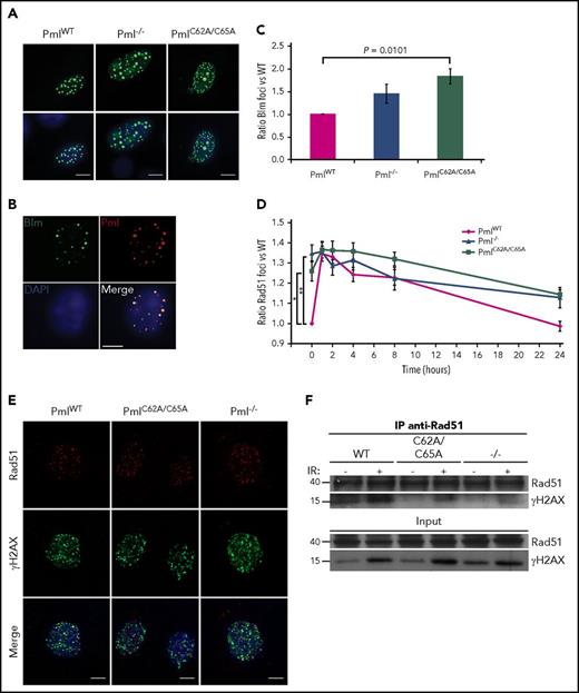 Figure 6. Reduced colocalization between Rad51 and γH2AX foci in PmlC62A/C65A and Pml−/−cells. (A) Representative images of PmlWT, Pml−/−, and PmlC62A/C65A MEFs overexpressing GFP-Blm (GFP-Blm, green; DAPI, blue). Scale bar, 10 μm. (B) Representative costaining images of Blm/Pml in PmlWT MEF overexpressing GFP-Blm (GFP-Blm, green; Pml, red; DAPI, blue). Scale bar, 10 μm. (C) Ratio of GFP-Blm foci in MEFs (n = 3). (D) Ratio of Rad51 foci in MEFs over a 24-hour time course following IR exposure (n = 3 per time point). (C-D) Two-tailed unpaired Student t test analyses were performed. *P < .05; **P < .01. (E) Representative images of irradiated MEFs immunostained for Rad51 (red), γH2AX (green), and DAPI (blue). Scale bar, 10 μm. (F) Coimmunoprecipitation experiments. Cells treated without (−) or 1 hour post-IR (+) exposure were lysed and immunoprecipitated (IP) with anti-Rad51 antibody and immunoblotted with anti-γH2AX antibody. Input is shown in the lower panels. The blots shown are representative of 3 independent experiments.