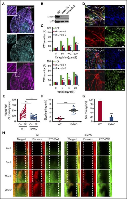 Figure 1. Myosin IIa is required for cAMP-mediated VWF secretion from endothelial cells both in vitro and in vivo. (A) Immunostaining of myosin IIa (cyan) and f-actin (magenta) in HUVECs (scale bar, 5 μm). (B) The western blot of the knockdown efficiency of the shRNAs against myosin IIa (shMyoIIa-1 and shMyoIIa-2). The p85 protein was used as a loading control. (C) VWF secretion from HUVECs expressing scrambled (SCR) or myosin IIa shRNAs (shMyoIIa-1 and shMyoIIa-2) with stimulation of forskolin or epinephrine at the indicated concentrations (n = 12; *P < .05, **P < .01). (D) Whole-mount staining to check the knockout (KO) efficiency of myosin IIa in the iEMKO mouse. Mouse ears were fixed and stained with anti-myosin IIa (green) and anti-CD31 (red) to label vascular endothelial cells (scale bars, 60 μm). (E) Normalized plasma levels of VWF in WT (n = 12) and iEMKO (n = 12) mice before (NS > 0.05) and after epinephrine (EPI) stimulation (**P < .01). Results were expressed as percentage of the value of pooled plasma from 5 WT mice. (F) Bleeding times in WT (n = 14) and iEMKO (n = 12) mice after epinephrine stimulation (***P < .001). (G) The graph showed the coverage of the area by thrombus in (H) at 20 min. (***P < .001; mean ± standard error of the mean). (H) FeCl3-induced thrombus formation in mesenteric vessels of WT (n = 10) and iEMKO (n = 8) mice at different points. Thrombus indicated by rhodamine-labeled platelets and fluorescein isothiocyanate (FITC)-conjugated anti-VWF antibody. All error bars represent standard deviation.
