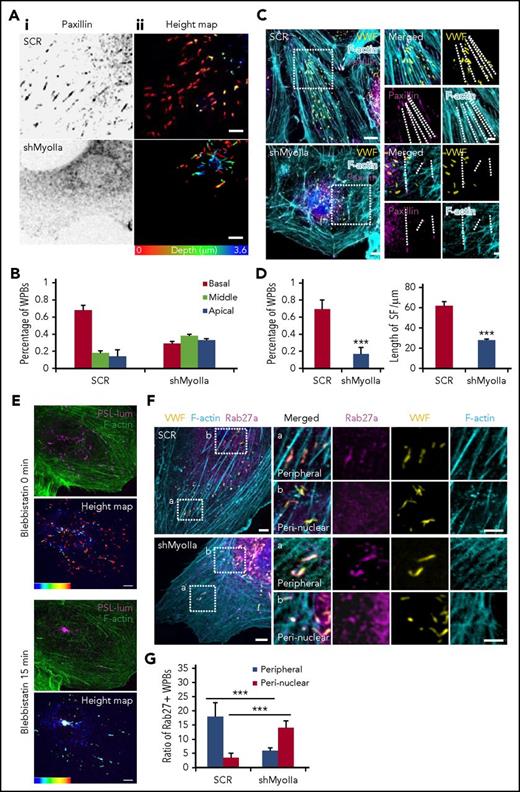 Figure 2. Myosin IIa, but not myosin IIb, is required for the peripheral distribution of Rab27a-positive WPBs. (Ai) Immunostaining of paxillin (black) in HUVECs expressing scrambled (SCR) and shRNA targeting myosin IIa (shMyoIIa). (Aii) Spinning disk confocal microscopy of the height map (depth was defined as the distance of WPBs to the basal membrane) of WPBs relative to the basal membrane in these HUVECs. Height of the basal membrane was defined as 0 μm (red), and the apical membrane was indicated in blue. (B) Statistics for the height of WPBs as in A. The height of WPBs was evenly divided into 3 layers: basal (red), middle (green), and apical (blue). (C) Representative images of immunostaining of VWF (yellow), F-actin (cyan), and paxillin (magenta) in cells expressing SCR and shMyoIIa. Dashed lines indicated FA-anchored SFs. (D) Percentage of WPBs along stress fibers and length of FA-anchored SFs, as in D. **P < .01, ***P < .001. (E) Representative real-time images and height maps with blebbistatin treatment in cells expressing P-selectin-lum-mCherry (PSL-lum-mCherry) and Lifeact-GFP. (F) Representative images of immunostaining of VWF (yellow), f-actin (cyan), and Rab27a (magenta) in cells expressing SCR and shMyoIIa. The magnified panels showed the peripheral region (a) and the peri-nuclear region (b). The peripheral region was defined as the region whose distance to nuclear was more than 10 μm. Arrows indicate the Rab27a-positive WPBs and arrowheads indicate the Rab27a-negative WPBs. (G) Quantitative analysis of the number of Rab27a-positive WPBs in perinuclear and peripheral regions (mean ± standard deviation. ***P < .001, Student’s t-test (scale bars, 5 μm; mean ± standard deviation).