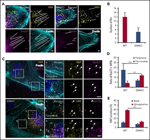 Figure 3. Myosin IIa-deleted ECs exhibit impaired mature WPB distribution and decreased cAMP-induced VWF secretion. (A) Cardiac endothelial cells isolated from WT and iEMKO mice and immunostained with antibodies against VWF (yellow) and paxillin (magenta). F-actin was labeled with phalloidin (cyan). (Right) Magnified insets. (B) Quantitative analysis of the number of FAs per cell as in A (n = 15; **P < .01, 3 independent experiments). (C) Confocal images of WT and iEMKO CECs immunostained with antibodies against VWF (yellow) and Rab27a (magenta). F-actin was labeled with phalloidin (cyan). Arrows indicate WPBs. (Right) Magnified insets. (D) Number of Rab27a-positive WPBs along stress fibers as in C (**P < .01; ***P < .001). (E) VWF secretion in CECs isolated from WT and iEMKO mice with epinephrine stimulation (n = 12; **P < .01, Student’s t-test; mean ± standard deviation; scale bars, 5 μm).