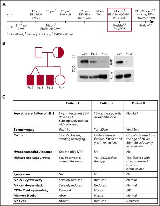 Figure 1. Timeline and clinical manifestations of the disease in the patients. (A) Timeline of clinical presentation of the disease in patients 1 and 2. (B) Family tree shows the carrier of the XIAP mutation (half-shaded) and the patients (shaded). The western immunoblot demonstrates a dramatic reduction in mutant XIAP expression in patients 1 to 3. (C) Clinical manifestation of XLP2 in patients 1 to 3. CAR-T, chimeric antigen receptor T cell; Con, control; IVIG, IV immunoglobulin; Pt., patient; y.o., years old.