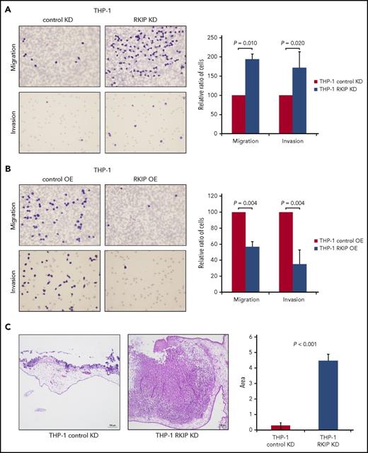 Figure 1. RKIP loss is involved in the development of MS. (A-B) Results of migration and invasion experiments using THP-1 AML cells with RKIP short hairpin RNA KD (A) and FLAG-RKIP OE (B). Representative images (40× magnification) of PET membranes with Giemsa-stained cells are displayed. The number of cells was counted with an inverted microscope. In all cases, cells carrying the empty control vectors (control KD and control OE, respectively) have been arbitrarily set to a value of 100, and the x-fold change in cells transduced with either RKIP short hairpin RNA (THP-1 RKIP KD) or FLAG-RKIP (THP-1 RKIP OE) was calculated using the ratio “number of cells RKIP KD/number of cells control KD” and “number of cells RKIP OE/number of cells control OE,” respectively. Graphs summarize the results of at least 3 independent experiments. Data are expressed as mean values ± standard deviation, and P values have been calculated using the Student t test. (C) Representative hematoxylin and eosin staining of chicken CAMs after seeding of THP-1 AML cells with RKIP KD (THP-1 RKIP KD) and without (THP-1 control KD) showing invasion and tumor formation in the THP-1 RKIP KD condition (10× magnification). The graph displays the area of invading cells/tumors as assessed by ImageJ and summarizes the results of 4 independent experiments. Data are expressed as mean values ± standard deviation, and P values have been calculated using the Student t test.