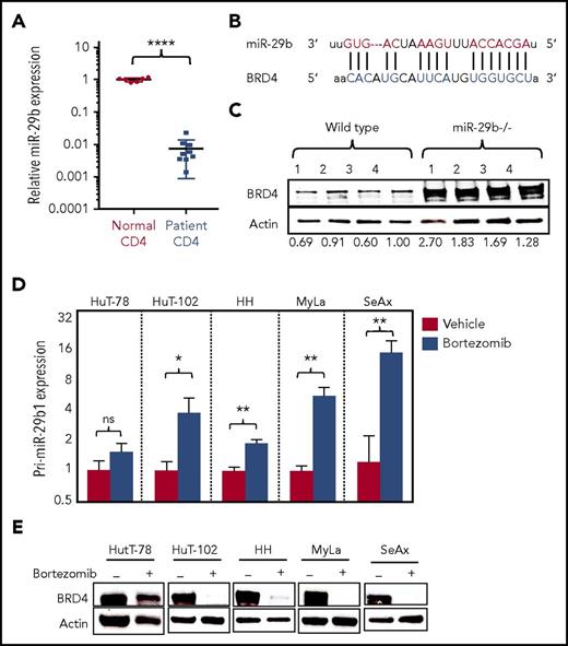 Figure 1. BRD4 is inversely correlated with miR-29b in CTCL. (A) Relative expression of miR-29b in peripheral blood CD4+ T cells from CTCL patients (n = 9) and normal donors (n = 6). (B) Sequence alignment of the mature miR seed sequence of miR-29b showing complementarity to the 3′UTR of BRD4. (C) Immunoblot analysis of BRD4 protein in splenocytes from miR-29b−/− and age-matched WT mice (n = 4 each). (D) RT-PCR analysis for pri-miR-29b1 in CTCL-derived CD4+ T-cell lines treated with 10 nM bortezomib showing a significant increase in pri-miR-29b1 level after 3 hours. Data are presented as mean ± standard error of the mean (SEM) (n = 3 each). (E) Immunoblot of BRD4 protein expression in CTCL-derived CD4+ T-cell lines treated with 50 nM bortezomib for 24 hours showing decreased expression in treated cells compared with dimethyl sulfoxide–treated controls. Data are presented as mean ± standard error of the mean (SEM). *P ≤ .05; **P ≤ .01; ***P ≤ .001; ****P ≤ .0001; unpaired 2-tailed Student t test. ns, not significant.