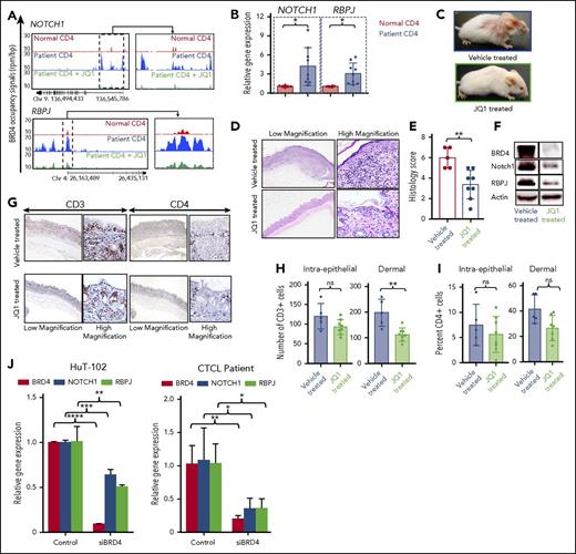 Figure 3. JQ1 reverses BRD4 binding–mediated enhanced oncogene expression in vivo. (A) Gene tracks depicting genomic occupancy of BRD4 (rpm per bp) at regulatory regions of NOTCH1 and RBPJ in CD4+ T cells from a normal donor, a CTCL patient, and patient cells treated with 100 nM JQ1 for 24 hours in vitro. (B) RT-PCR of transcript levels of NOTCH1 and RPBJ in peripheral blood CD4+ T cells from normal donors (n = 6) and CTCL patients (n = 9). (C) Clinical images of representative IL-15 transgenic FVB/N mice treated intraperitoneally with 10% cyclodextran vehicle (above) or 50 mg/kg JQ1 (below) for 4 weeks. (D) Photomicrographs of skin from representative IL-15 transgenic CTCL mice treated with vehicle or JQ1. Hematoxylin and eosin stain, 40× (left), 400× (right). (E) Histology lesion severity score of skin tissue from mice treated with vehicle (n = 5) or JQ1 (n = 7). (F) Immunoblot of BRD4, NOTCH1, and RBPJ from skin tissue of IL-15 transgenic CTCL mice treated with vehicle or 50 mg/kg JQ1 with actin as an internal control. (G) Photomicrographs of skin from representative IL-15 transgenic mice treated with vehicle or JQ1. Immunohistochemistry for mouse CD3 (40×, left; 400×, right) and immunohistochemistry for mouse CD4 (40×, left; 400×, right). (H) Counts of CD3+ cells within surface and follicular epithelium (left) and within the superficial dermis (right) in vehicle-treated and JQ1-treated mice. (I) Counts of CD4+ cells within surface and follicular epithelium (left) and within the superficial dermis (right) in vehicle-treated and JQ1-treated mice. (J) RT-PCR of BRD4, NOTCH1, and RBPJ transcript levels in CTCL cell line HuT-102 transfected with 0.15 nmol siRNA to BRD4 for 24 hours (left). RT-PCR of BRD4, NOTCH1, and RBPJ transcript levels in CTCL patient CD4+ T cells transfected with 0.15 nmol siRNA to BRD4 for 24 hours (right). Data are presented as mean ± SEM unless otherwise specified. *P ≤ .05; **P ≤ .01; ***P ≤ .001; ****P ≤ .0001; unpaired 2-tailed Student t test.