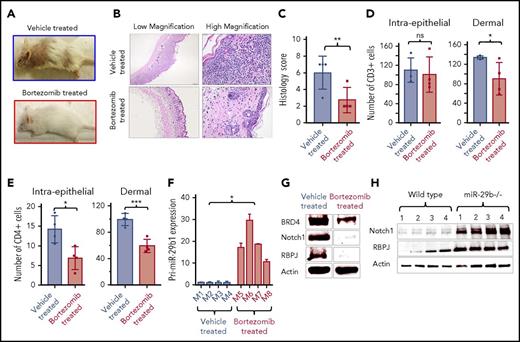 Figure 4. Bortezomib increases miR-29b and decreases oncogene expression in vivo. (A) Clinical images of representative IL-15 transgenic CTCL mice treated intraperitoneally with PBS vehicle (above) or 1 mg/kg bortezomib (below) for 5 weeks. (B) Photomicrographs of skin from representative IL-15 transgenic CTCL mice treated with vehicle (PBS/dimethyl sulfoxide) or bortezomib. Hematoxylin and eosin stain (40×, left; 400×, right). (C) Histology lesion severity score of skin tissue from mice treated with vehicle (n = 4) or bortezomib (n = 4). (D) Counts of CD3+ cells within surface and follicular epithelium (left) and within the superficial dermis (right) in vehicle-treated and bortezomib-treated mice. (E) Counts of CD4+ cells within surface and follicular epithelium (left) and within the superficial dermis (right) in vehicle-treated and bortezomib-treated mice. (F) RT-PCR of pri-miR-29b1 in blood of bortezomib-treated mice (n = 4) compared with vehicle-treated mice (n = 4). (G) Immunoblot analysis of BRD4, NOTCH1, and RBPJ from skin tissue of IL-15 transgenic CTCL mice treated with vehicle or 1 mg/kg bortezomib, with actin as an internal control. (H) Immunoblot of NOTCH1 and RBPJ protein expression in splenocytes from miR-29b−/− mice compared with that of age-matched WT mice. Data are presented as mean ± SEM unless otherwise specified. *P ≤ .05; **P ≤ .01; ***P ≤ .001; ****P ≤ .0001; unpaired 2-tailed Student t test.