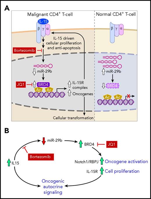 Figure 6. Working model. (A) IL-15 receptor signaling in malignant cells (left) and normal CD4+ T cells (right). IL-15 cytokine binds its receptor complex α-β-γ to drive intracellular signaling, which includes reducing the level of miR-29b in cells. Decreased miR-29b releases negative regulation on BRD4 which then binds acetylated lysine residues on chromatin to direct gene expression. Upregulated genes include oncogenes and IL-15 receptor complex constituents, which drive cellular proliferation and resistance to apoptosis. Bortezomib inhibits the pathways that lead to decreased miR-29b expression, whereas JQ1 reduces BRD4 binding of chromatin, and both of these therapeutic strategies reduce oncogene and IL-15 receptor complex expression. In nonmalignant CD4+ T cells, miR-29b basal levels are higher, and BRD4 binding is relatively low. (B) IL-15 autocrine signaling loop. The regulatory pathway described facilitates formation of a self-sustaining autocrine loop that drives oncogene activation and cellular proliferation. This loop can be disrupted through use of bortezomib and JQ1.