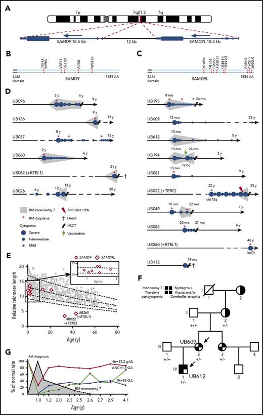 Figure 5. Characteristics in patients with SAMD9L and SAMD9 mutations. (A) G-banding ideogram of human chromosome 7 with genomic location of the tandem SAMD9 and SAMD9L genes. (B-C) Graphical representation of SAMD9L and SAMD9 proteins, respectively. Amino acid changes are indicated; see additional details in supplemental Figures 6 and 7. (D) Schematic of hematological history from birth to latest follow-up in the 16 patients with SAMD9 or SAMD9L mutations; see family trees in supplemental Figures 6 and 7, clinical characteristics in Table 4 and somatic evolution in supplemental Table 12. Median age of the SAMD9L and SAMD9 mutated patients at diagnosis was 13 months and 7 years, respectively (range, 8 months to 46 years, and 2 to 21 years, respectively). (E) Telomere length in PBMCs in 8 SAMD9L and 3 SAMD9 mutated patients, measured by flow cytometry fluorescence in situ hybridization. The vertical axis shows the relative telomere length determined in comparison with a control tetraploid cell line per percentage, whereas the horizontal axis displays age. Only 2 patients had short telomeres, and they also had a TERC and a RTEL1 mutation, respectively. (F) Family tree for patients UB609 and UB612 (arrows). The germ line SAMD9L mutation status is shown for the family members; +/−, heterozygous c.C2956T; +/+, no mutation. Patient UB612 (IV-1) was diagnosed with severe BMF and monosomy 7 without BM dysplasia at the age of 13 months. Transplantation was planned but eventually cancelled because his blood cell counts improved spontaneously. This patient is now 5 years old, without residual cytopenia or monosomy 7. His mother, patient UB609 (III-2), experienced a rather similar story 32 years previously; when she was 13 months old she was diagnosed with severe AA and BM transplantation was planned, which was also cancelled due to spontaneous improvement. Although they were not included in our IBMF cohort, we managed to investigate more patients in this family. The mother’s sister (III-3) also had early transitory pancytopenia, and both sisters, now aged 33 and 37 years, are doing well. Interestingly, the grandmother (II-2) had a cerebellar atrophy with ataxia, a nystagmus and the SAMD9L mutation found in her oral swab, whereas her own mother (I-2) also had the same neurological phenotype but could not be genetically explored. (G) Blood cell counts over time for patient UB612. The red curve indicates the hemoglobin concentration (Hb); light brown, the absolute neutrophil count (ANC); whereas the blue line indicates platelet counts (Pt). The gray area indicates the detection of monosomy 7 on marrow karyotyping.